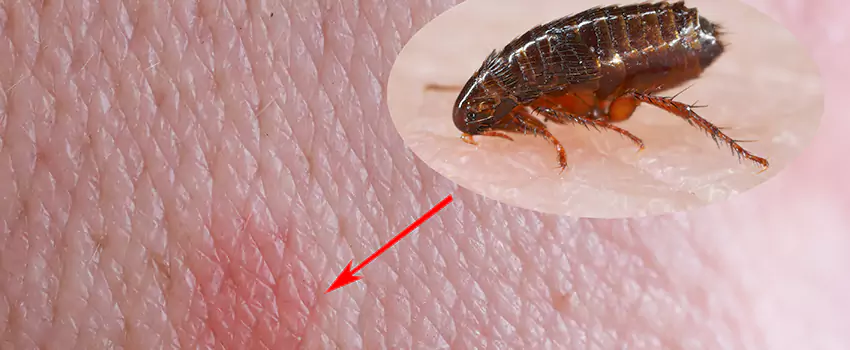 Flea Control for Humans Chula Vista, CA